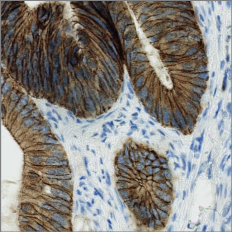 immunohistochemistry